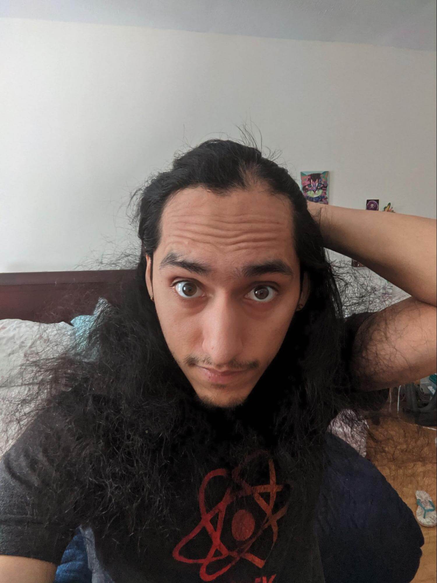 Steven Jimenez looking in the mirror noticing a patch of hair loss from alopecia