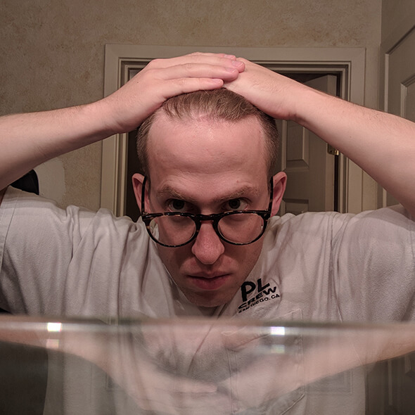 Chuck holds his hair back, looking in the bathroom mirror for one of his hairline status-checks. It’s not looking good.