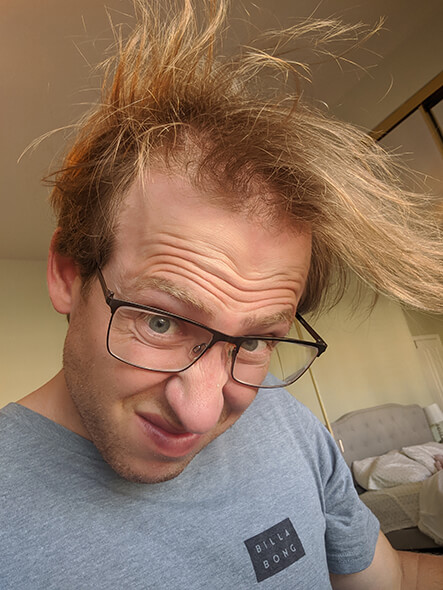 Chuck leans over for a selfie so his hair looks like it’s coming towards the camera. It’s getting more difficult to deal with hair loss. You can see his head between the sparse and thin hair on top of his head.