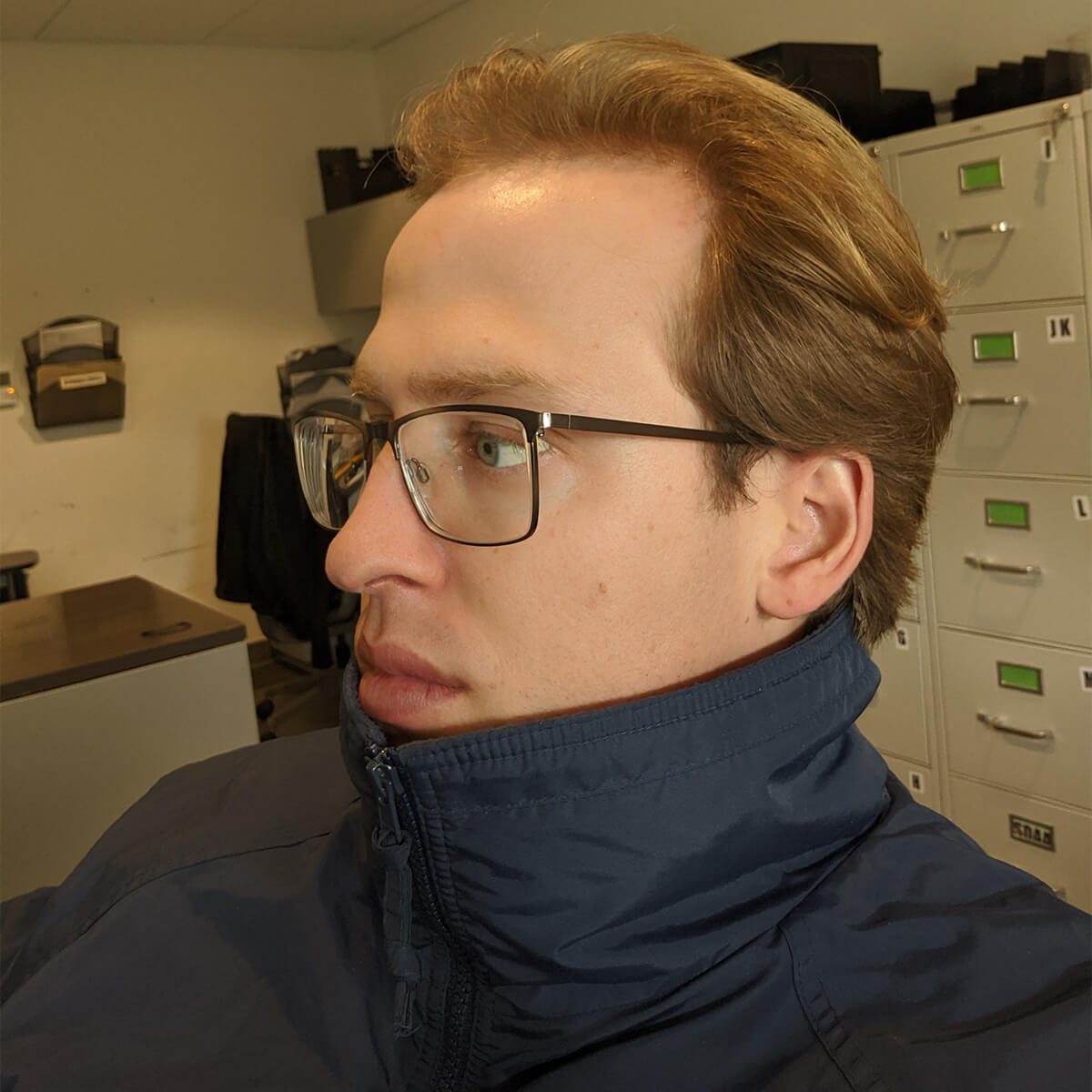 Chuck looking to the side at the lowest point of his hair loss, shiny head, hairless deep into the sides of his temple with a thinning peninsula of hair on top.