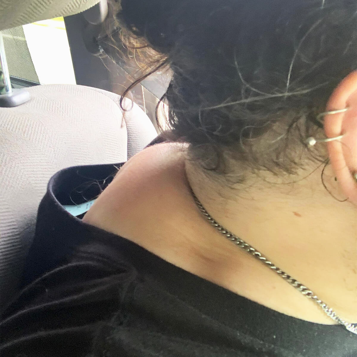 The back of Danny's neck, bulging with and unhealthy amount of excess body fat, pre transformation.