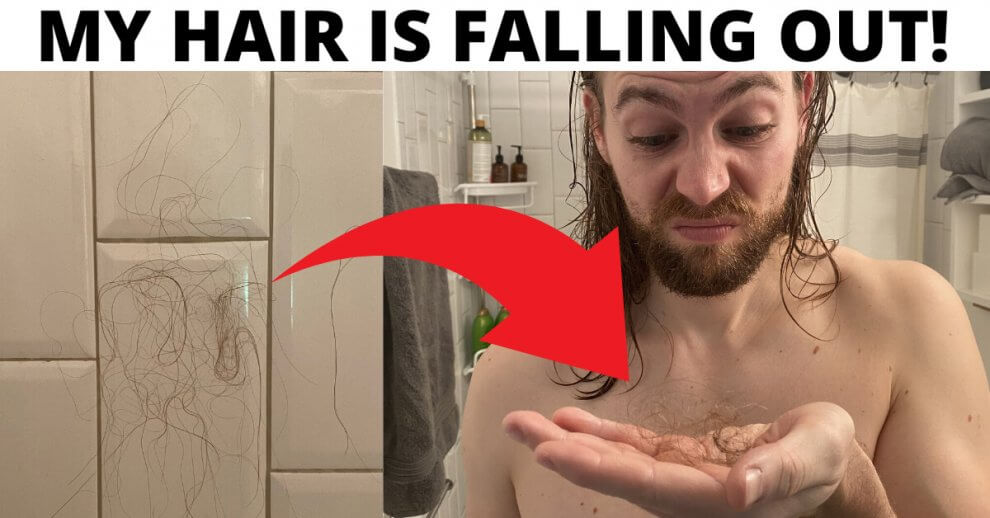 My Hair Is Falling Out